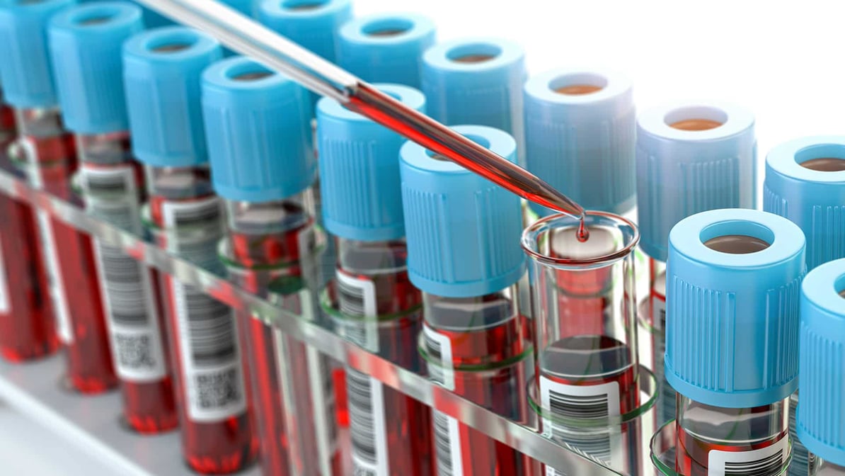 kitting d'échantillons cliniques (1)